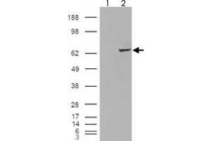 293 overexpressing IGF2BP2 and probed with IGF2BP2 polyclonal antibody  (mock transfection in first lane), tested by Origene. (IGF2BP2 antibody)