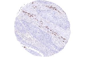 Immunohistochemistry (IHC) image for Rabbit anti-Human IgA antibody (ABIN7477497)