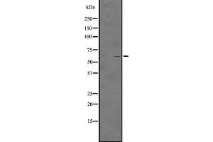 Western blot analysis of GPR97 expression in HL60 cell line lysates ;,The lane on the left is treated with the antigen-specific peptide. (GPR97 antibody  (N-Term))