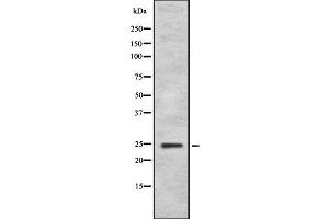 Western blot analysis FGF11 using HeLa whole cell lysates