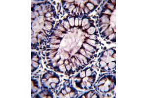Immunohistochemistry (Paraffin-embedded Sections) (IHC (p)) image for anti-Polymeric Immunoglobulin Receptor (PIGR) (AA 646-672), (C-Term) antibody (ABIN652495)