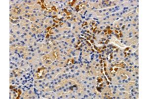 anti-Chromosome 3 Open Reading Frame 20 (C3ORF20) antibody