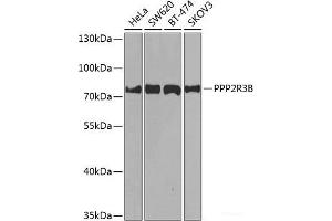 Western blot analysis of extracts of various cell lines using PPP2R3B Polyclonal Antibody at dilution of 1:1000. (PPP2R3B antibody)