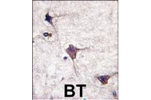 Formalin-fixed and paraffin-embedded human brain tissue reacted with hPCPTP1-, which was peroxidase-conjugated to the secondary antibody, followed by DAB staining. (PTPRR antibody  (N-Term))