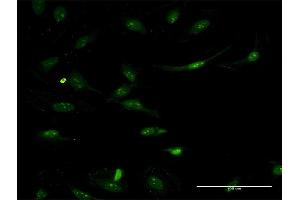 Immunofluorescence of monoclonal antibody to ASS1 on HeLa cell.