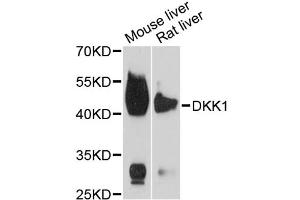 Western blot analysis of extracts of various cell lines, using DKK1 antibody (ABIN5971387) at 1/1000 dilution. (DKK1 antibody)