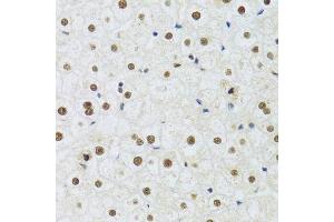Immunohistochemistry of paraffin-embedded human liver using DDB1 Antibody. (DDB1 antibody)