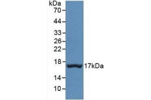 Detection of Recombinant TTR, Human using Monoclonal Antibody to Prealbumin (PALB) (TTR antibody  (AA 21-147))