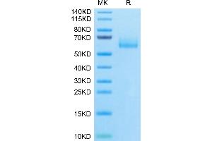 Human MUC1 Isoform Y on Tris-Bis PAGE under reduced condition. (MUC1 Protein (AA 24-158) (Fc Tag))