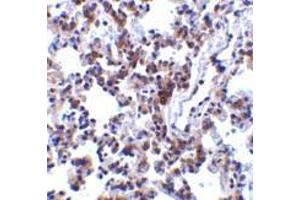 Immunohistochemistry of BAP31 in rat lung tissue with BAP31 antibody at 2 μg/ml. (BCAP31 antibody  (C-Term))