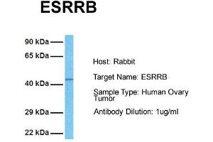 Host: Rabbit Target Name: ESRRB Sample Tissue: Human Ovary Tumor Antibody Dilution: 1.