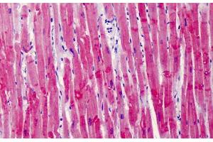 Human Heart: Formalin-Fixed, Paraffin-Embedded (FFPE) (Cardiac Troponin T2 antibody  (AA 146-160))