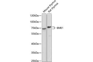 Western blot analysis of extracts of various cell lines, using EME1 antibody (ABIN6127301, ABIN6140155, ABIN6140156 and ABIN6224416) at 1:1000 dilution. (Crossover junction endonuclease EME1 (EME1) (AA 1-320) antibody)