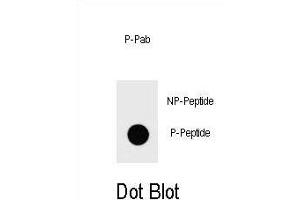 Dot blot analysis of Phospho-IKKB- Antibody Phospho-specific Pab g on nitrocellulose membrane.