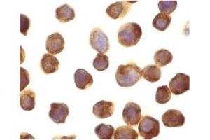 Immunohistochemistry (IHC) image for anti-Death-Associated Protein Kinase 3 (DAPK3) (Middle Region) antibody (ABIN1031183) (DAPK3 antibody  (Middle Region))