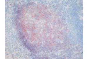 Immunohistochemistry (IHC) image for anti-CD19 Molecule (CD19) antibody (ABIN781711) (CD19 antibody)