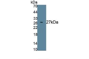 Detection of Recombinant KLK3, Rat using Polyclonal Antibody to Prostate Specific Antigen (PSA) (Prostate Specific Antigen antibody  (AA 68-255))