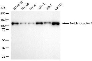 Western blotting analysis using notch receptor 1 antibody (ABIN7799625).