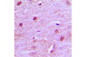 Immunohistochemical analysis of MNAT1 staining in human brain formalin fixed paraffin embedded tissue section. (MNAT1 antibody  (Center))