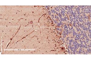 Antibody (2µg/ml) staining of paraffin embedded Human Cerebellum. (Doublecortin antibody  (AA 232-242))