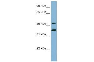 WB Suggested Anti-BLNK Antibody Titration:  0. (B-Cell Linker antibody  (Middle Region))