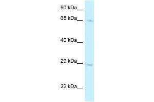 Western Blot showing MUS81 antibody used at a concentration of 1 ug/ml against A549 Cell Lysate (MUS81 antibody  (C-Term))