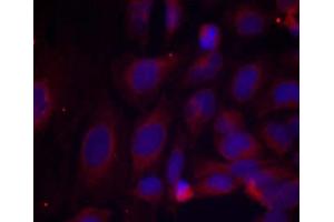 Immunofluorescence staining of methanol-fixed HeLa cells using NF-κB p105/p50 (phospho- Ser893) antibody (E011018 Red). (NFKB1 antibody  (pSer893))