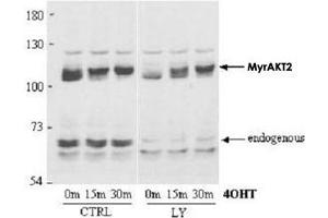Immunoblotting of AKT2 polyclonal antibody  to AKT2 wasused at a 1 : 1,000 dilution to detect AKT2 by Western blot. (AKT2 antibody  (AA 455-468))
