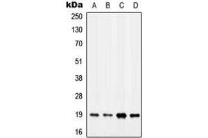 Western blot analysis of MYL7 expression in MCF7 (A), K562 (B), SP2/0 (C), H9C2 (D) whole cell lysates. (MYL7 antibody  (Center))