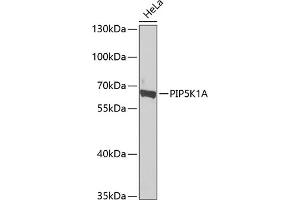 Western blot analysis of extracts of HeLa cells, using PIP5K1A antibody  at 1:1000 dilution. (PIP5K1A antibody  (AA 231-500))