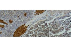 Immunohistochemistry of paraffin-embedded Mouse spleen tissue using IL2RA Monoclonal Antibody at dilution of 1:500 . (CD25 antibody)