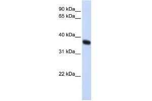 WB Suggested Anti-ZNF364 Antibody Titration:  0.