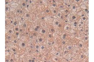 Detection of TGFb3 in Human Liver Tissue using Polyclonal Antibody to Transforming Growth Factor Beta 3 (TGFb3) (TGFB3 antibody  (AA 24-300))