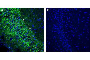 Expression of SV2A in rat hippocampusImmunohistochemical staining of perfusion-fixed frozen rat brain sections using Anti-SV2A Antibody (ABIN7581988), (1:300), followed by goat anti-rabbit-AlexaFluor-488.