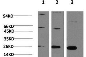 Western Blot analysis of 1) Hela, 2)3T3, 3) PC-12 cells using CBX3 Monoclonal Antibody at dilution of 1:1000. (CBX3 antibody)