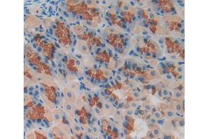 Used in DAB staining on fromalin fixed paraffin- embedded stomach tissue (MCCC2 antibody  (AA 380-563))