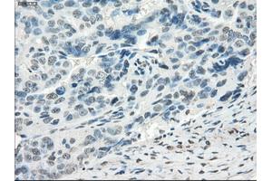 Immunohistochemical staining of paraffin-embedded colon tissue using anti-FOSL1mouse monoclonal antibody.