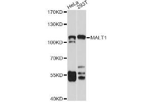 Western blot analysis of extracts of various cell lines, using MALT1 antibody (ABIN5971171) at 1/1000 dilution. (MALT1 antibody)