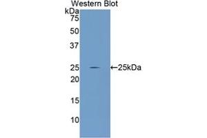 Western blot analysis of the recombinant protein. (GCLC antibody  (AA 435-636))