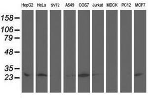 Image no. 3 for anti-Adenylate Kinase 4 (AK4) antibody (ABIN1496524) (AK4 antibody)