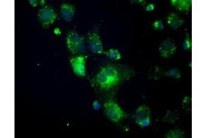 Anti-CRYAB mouse monoclonal antibody (ABIN2452579) immunofluorescent staining of COS7 cells transiently transfected by pCMV6-ENTRY CRYAB (RC202718). (CRYAB antibody)