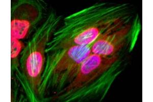 ICC staining of human HeLa cells using recombinant Acetyl Lysine antibody (red). (Recombinant Acetylated Lysine antibody)