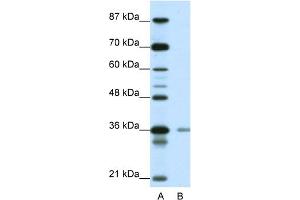 Western Blotting (WB) image for anti-Hypoxia Inducible Factor 1, alpha Subunit Inhibitor (HIF1AN) (N-Term) antibody (ABIN2781043)