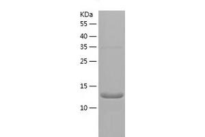Western Blotting (WB) image for Retinitis Pigmentosa 9 (Autosomal Dominant) (RP9) (AA 1-155) protein (His tag) (ABIN7124840)