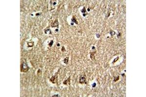 IHC analysis of FFPE human brain tissue stained with RAN antibody (RAN antibody  (AA 12-39))