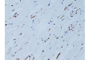 Immunohistochemistry of paraffin-embedded human breast using SELE Antibody. (Selectin E/CD62e antibody)