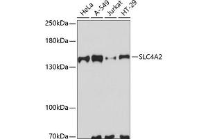 Western blot analysis of extracts of various cell lines, using SLC4 antibody (ABIN6129885, ABIN6148011, ABIN6148012 and ABIN6223666) at 1:3000 dilution. (SLC4A2 antibody  (AA 200-300))
