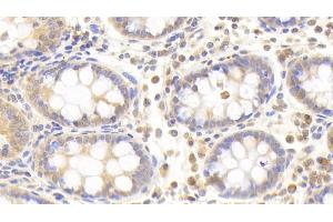 Detection of PLCd4 in Human Colon Tissue using Polyclonal Antibody to Phospholipase C Delta 4 (PLCd4) (PLCD4 antibody  (AA 1-250))