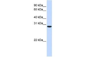 WB Suggested Anti-C18orf10 Antibody Titration: 0. (TPGS2 antibody  (Middle Region))