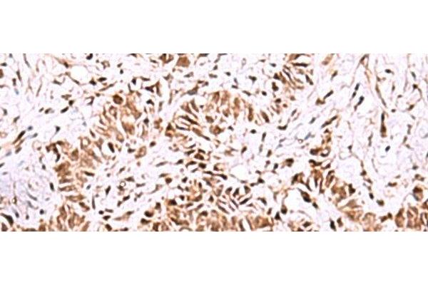 ISY1-RAB43 Readthrough (ISY1-RAB43) anticorps